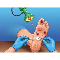 Foot Doctor Simulator