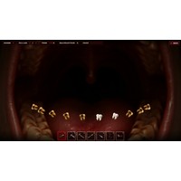 Teeth Puller